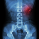 Illustration for article titled New Online Tool Can Predict If You'll Have Another Kidney Stone